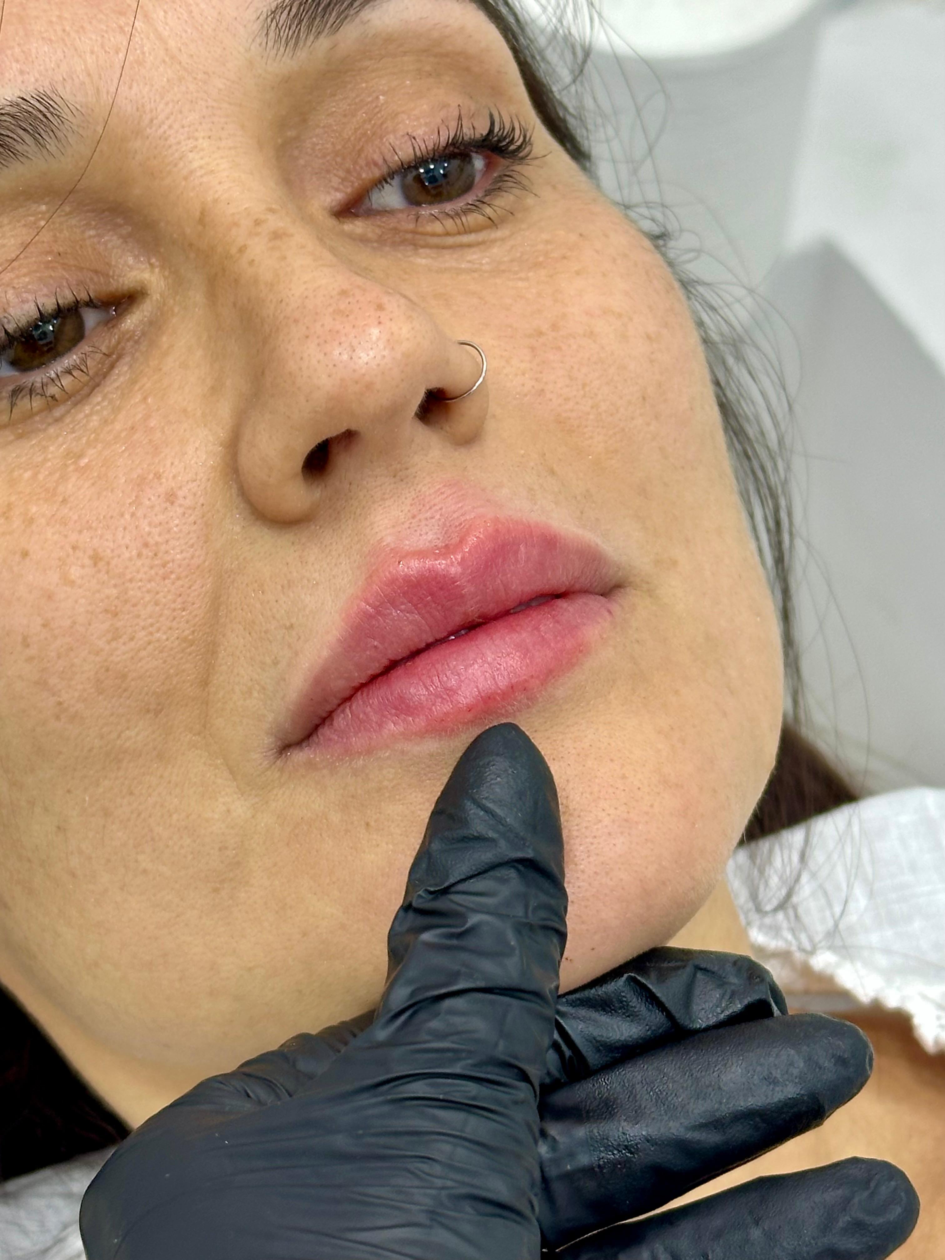 Armonización después